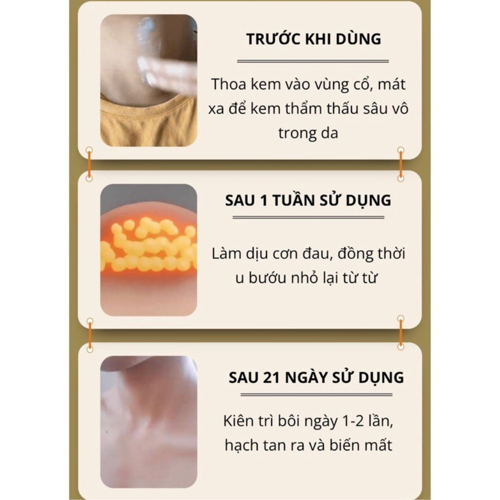 Kem Tan Hạch Bạch Huyết Nhật Bản - Hỗ Trợ Teo Hạch, Lưu Thông Mạch Máu, Giảm Bướu Cổ Hiệu Quả