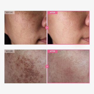 Tosowoong Arbutin 7% Tranexamic Acid 4% Cream Brightening   50ml