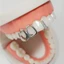 CATIYAHA Hip Hop Răng Grillz, Màu Vàng Sáng Bóng Grillz, Đôi Trái Tim Rỗng Đồng Răng Mũ Phong Cách Punk