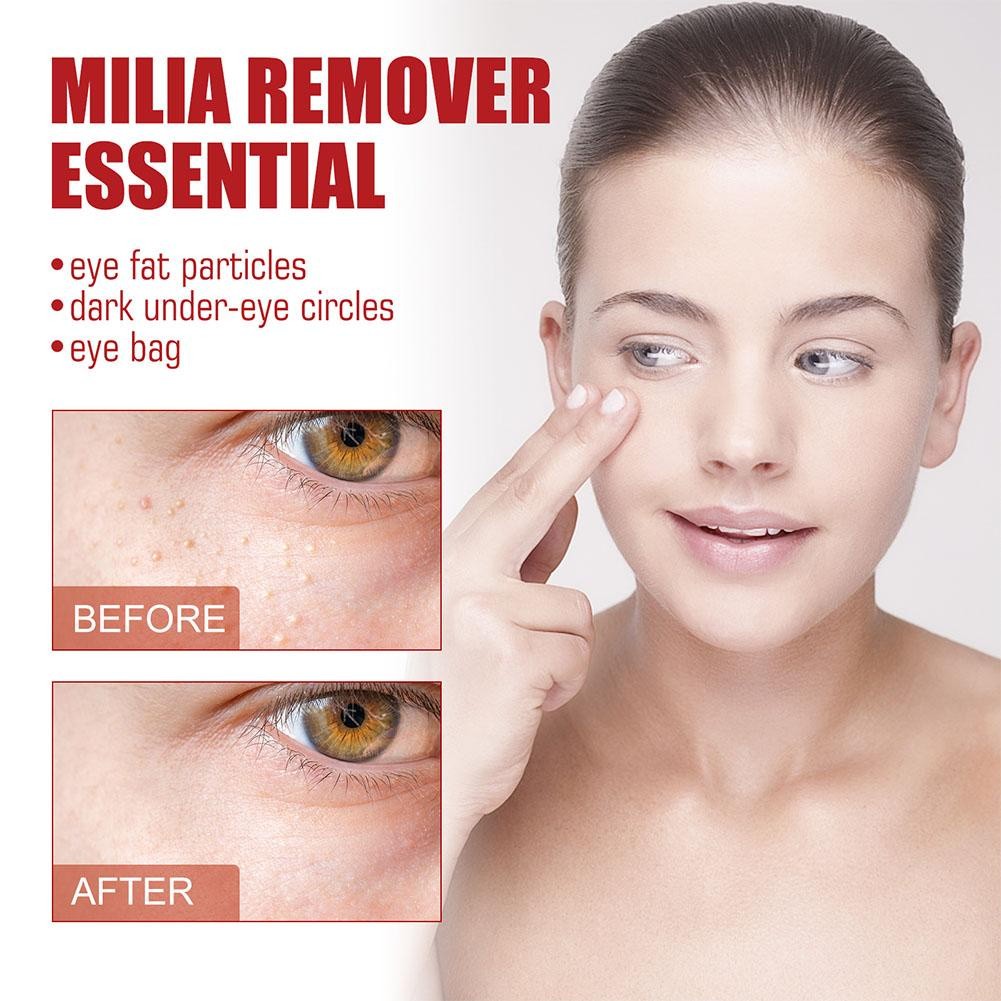 Learnever Mỡ Hạt Loại Bỏ Serum Phai Màu Vòng Tròn Tối Dưỡng Ẩm Mắt Mịn Phai Màu Tinh Chất Đường Tinh Chất H5o3