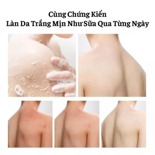 Sữa Tắm Trắng Da Sạch Mụn 500ml Làm Sạch Lưu Hương Lâu Làm Sạch Tận Sâu Lỗ Chân Lông Dưỡng Ẩm Trắng Sáng Mịn Màng