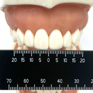 Thước kẹp nha khoa đo hai mặt, đo dọc, đo khoảng cách răng, chính xác, thẩm mỹ