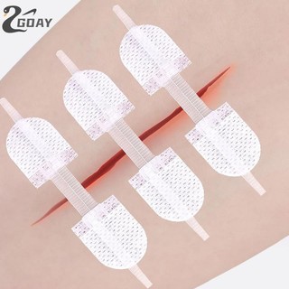 GOAY Dây Kéo Miếng Dán Đóng Vết Thương Thoáng Khí Liền Mạch Co Giãn Zip Khâu Băng Cho Chăm Sóc Vết Thương Nẹp Hỗ Trợ VN