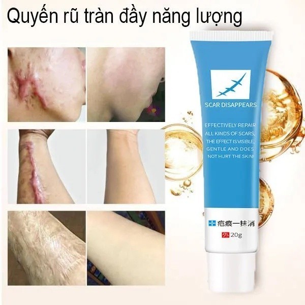 [CHÍNH HÃNG] Kem xóa sẹo nhanh chóng, vết sẹo trầy xước, vết bỏng, vết thương sau phẫu thuật, vết rạn da tăng