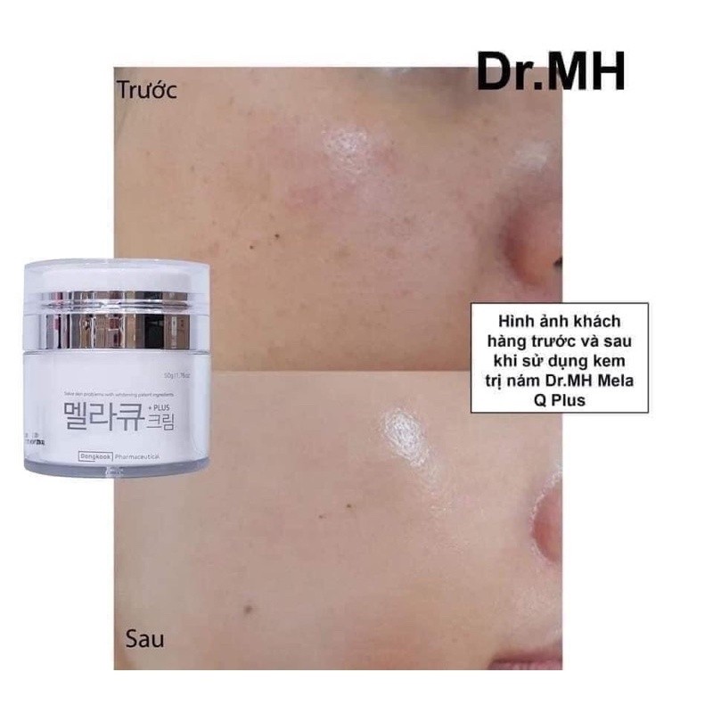 Kem nám Mela M Whitening Magic Cream,50g - hạn 2028 Hàn Quốc, trắng da, mờ nám thâm mụn tàn nhang  IS120