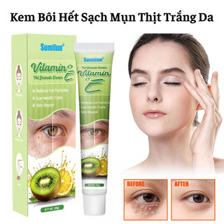 Kem Bôi Hết Sạch Mụn Thịt Quanh Mắt Và Toàn Bộ Cơ Thể  Bổ Sung Vitamin E Làm Trắng Sáng Da