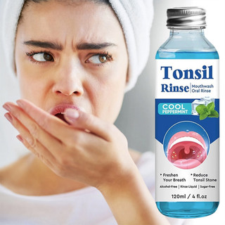 Tonsil Stone Rinse Natural Gentle Relief Anti-Bad Breath Travel-Friendly Dissolver