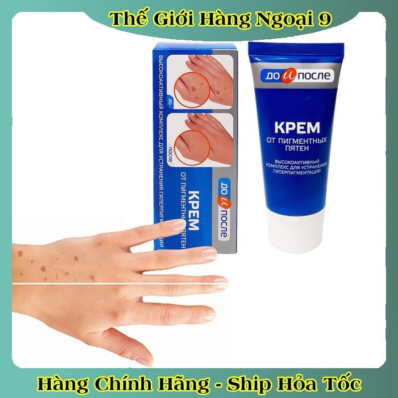 Kem đồi mồi Kpem Nga 50ml xóa mờ đồi mồi tay, tàn nhang dưỡng da tay trắng sáng mịn màng của Nga