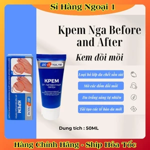Kem đồi mồi Kpem Nga 50ml xóa mờ đồi mồi tay, tàn nhang dưỡng da tay trắng sáng mịn màng của Nga