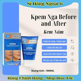 [DATE MỚI] Kem bôi chống nứt gót chân, giảm đồi mồi, nhăn tay Kpem Nga Before and After