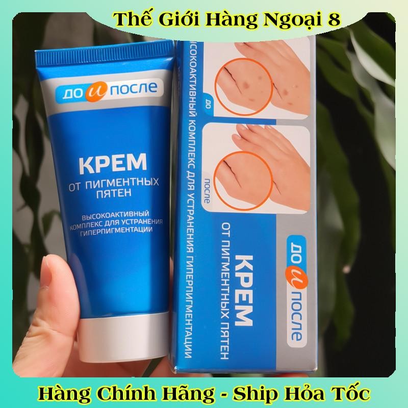 Kem đồi mồi Kpem Nga 50ml xóa mờ đồi mồi tay, tàn nhang dưỡng da tay trắng sáng mịn màng của Nga