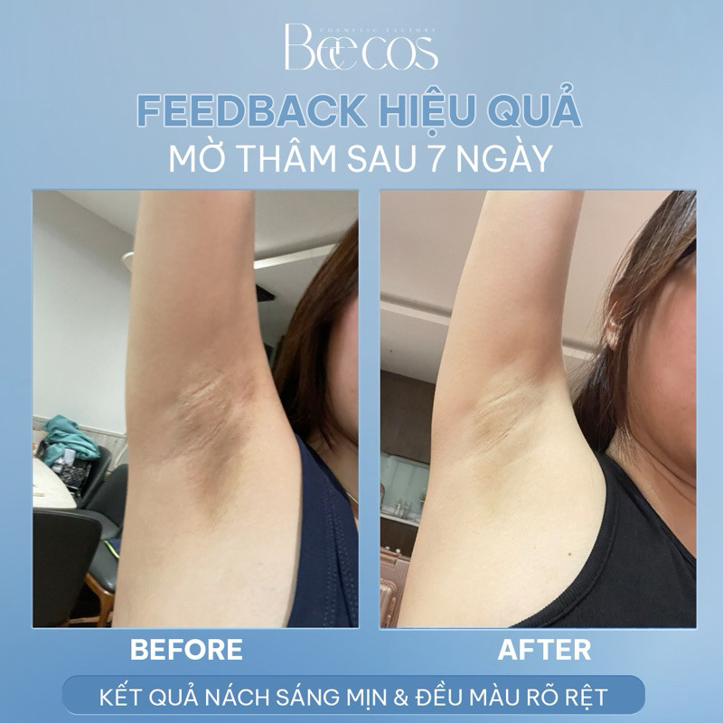[Chính Hãng] Combo 38 Gạc lau khử mùi và giảm tiết mồ hôi tay, chân và nách DEO FRESH Beecos