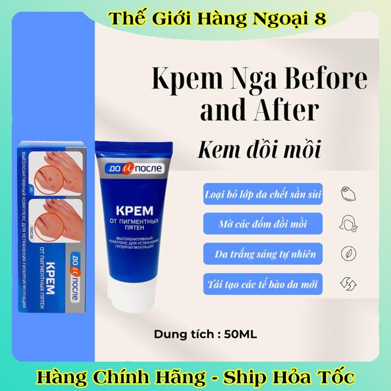 Kem đồi mồi Kpem Nga 50ml xóa mờ đồi mồi tay, tàn nhang dưỡng da tay trắng sáng mịn màng của Nga