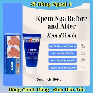 [DATE MỚI] Kem bôi chống nứt gót chân, giảm đồi mồi, nhăn tay Kpem Nga Before and After