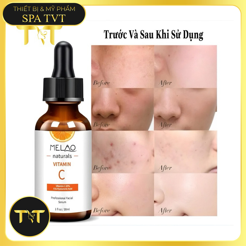 SERUM VITAMIN C MELAO 30ML – GIẢM THÂM, DƯỠNG TRẮNG, CHỐNG OXY HÓA, CẢI THIỆN DA XỈN MÀU