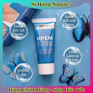 [ DATE MỚI] Kem Giảm Và Phục Hồi Nứt Nẻ Gót Chân Kpem 50ml của Nga