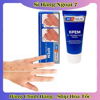 Kem đồi mồi Kpem Nga 50ml xóa mờ đồi mồi tay, tàn nhang dưỡng da tay trắng sáng mịn màng của Nga