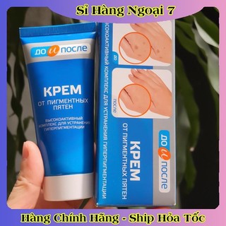 Kem đồi mồi Kpem Nga 50ml xóa mờ đồi mồi tay, tàn nhang dưỡng da tay trắng sáng mịn màng của Nga