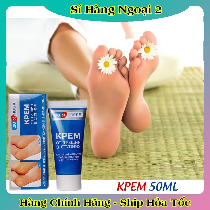 [ DATE MỚI] Kem Giảm Và Phục Hồi Nứt Nẻ Gót Chân Kpem 50ml của Nga