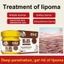 Kem Bôi Bướu Cổ Tuyến Giáp Lipoma, Kem Bôi U Bướu Mỡ Lipoma Cream 20gr, Không Đau Nhức, Hiệu Quả Cao - Thỏ Cosmetic