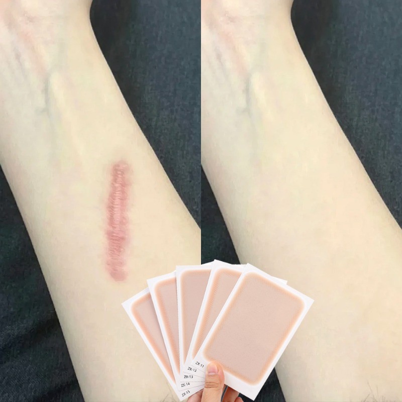 5 Miếng Dán Che Khuyết Điểm Hình Xăm - Birthmark Hide Tapes - Miếng Dán Che Sẹo - Kem Hỗ trợ giảm mụn - Hình Xăm Giả Cơ Thể - Trang Trí Nghệ Thuật DIY - Vô Hình, Chống Thấm Nước, Mô Phỏng