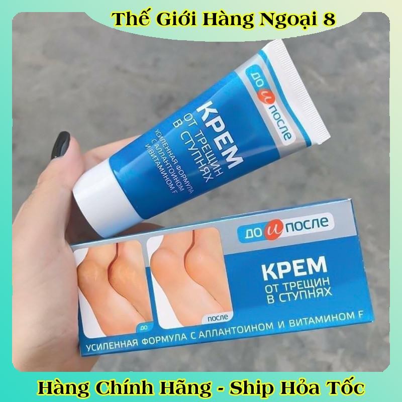 [ DATE MỚI] Kem Giảm Và Phục Hồi Nứt Nẻ Gót Chân Kpem 50ml của Nga