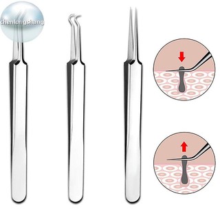 Chenlongshang 8CM Cell Pimples Blackhead Clip Nhíp Thẩm Mỹ Viện Cạo Đặc Biệt Đóng Hiện Vật Hỗ trợ giảm mụn Dụng Cụ EN