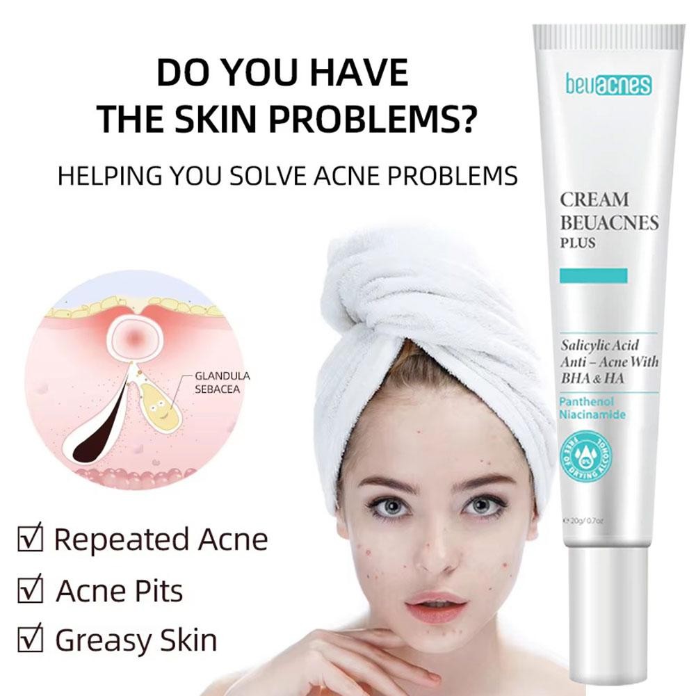 Kem Hỗ trợ giảm mụn Mặt Làm Sáng Điểm Mụn Dưỡng Ẩm Da Mụn 15g Và Làm Đẹp Da Thoải Mái G4r3
