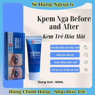 [DATE MỚI] Kem bôi chống nứt gót chân, giảm đồi mồi, nhăn tay Kpem Nga Before and After