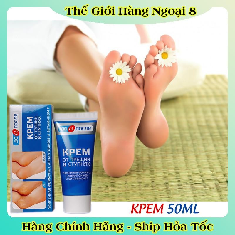 [ DATE MỚI] Kem Giảm Và Phục Hồi Nứt Nẻ Gót Chân Kpem 50ml của Nga