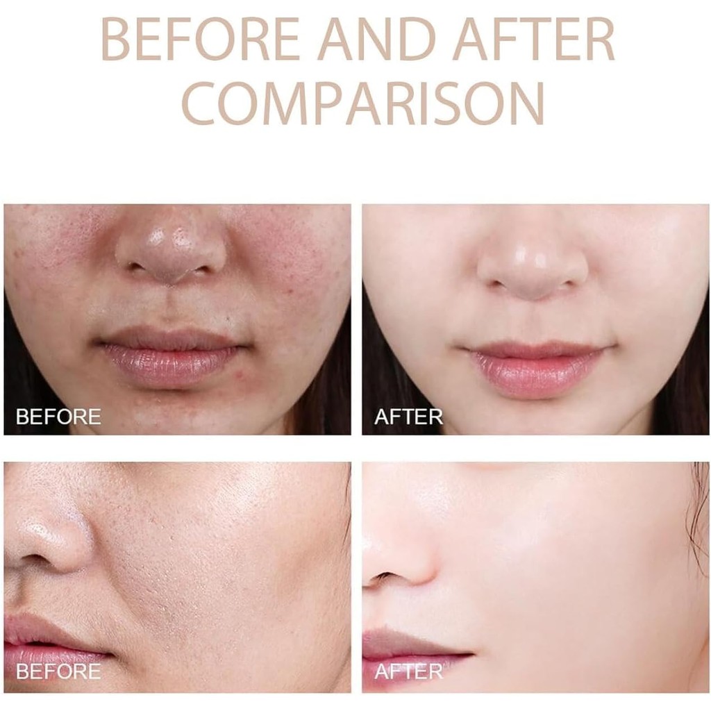 Ảnh Gel tẩy tế bào chết Grantadmit, Gel tẩy tế bào chết thanh lọc Grantadmit, Thanh lọc để làm sạch sâu mặt, Tẩy tế bào chết cho mặt, Sữa rửa mặt nhẹ nhàng cho mọi loại da, Làm sạch bụi bẩn 2