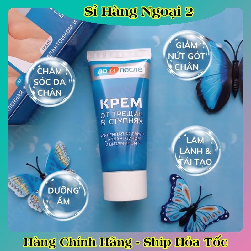 [ DATE MỚI] Kem Giảm Và Phục Hồi Nứt Nẻ Gót Chân Kpem 50ml của Nga