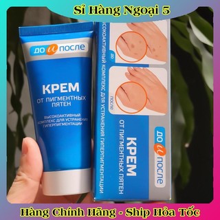 Kem đồi mồi Kpem Nga 50ml xóa mờ đồi mồi tay, tàn nhang dưỡng da tay trắng sáng mịn màng của Nga