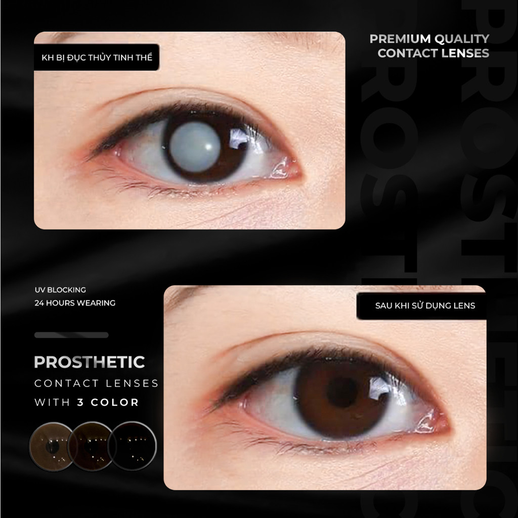 Lens Thẩm Mỹ Che Khuyết Điểm An.gel Ey.es, Kính Áp Tròng Cho Mắt Bị Đục Thủy Tinh Thể, Kéo Mây, Cườm