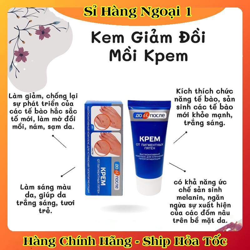 Kem đồi mồi Kpem Nga 50ml xóa mờ đồi mồi tay, tàn nhang dưỡng da tay trắng sáng mịn màng của Nga