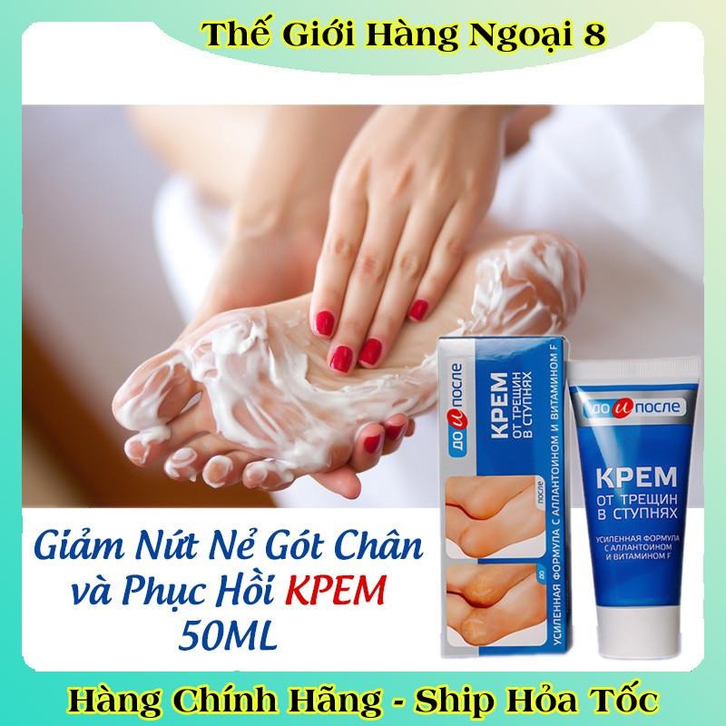 [ DATE MỚI] Kem Giảm Và Phục Hồi Nứt Nẻ Gót Chân Kpem 50ml của Nga