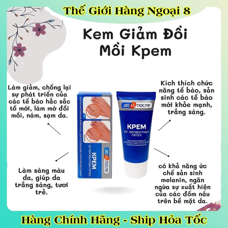 Kem đồi mồi Kpem Nga 50ml xóa mờ đồi mồi tay, tàn nhang dưỡng da tay trắng sáng mịn màng của Nga