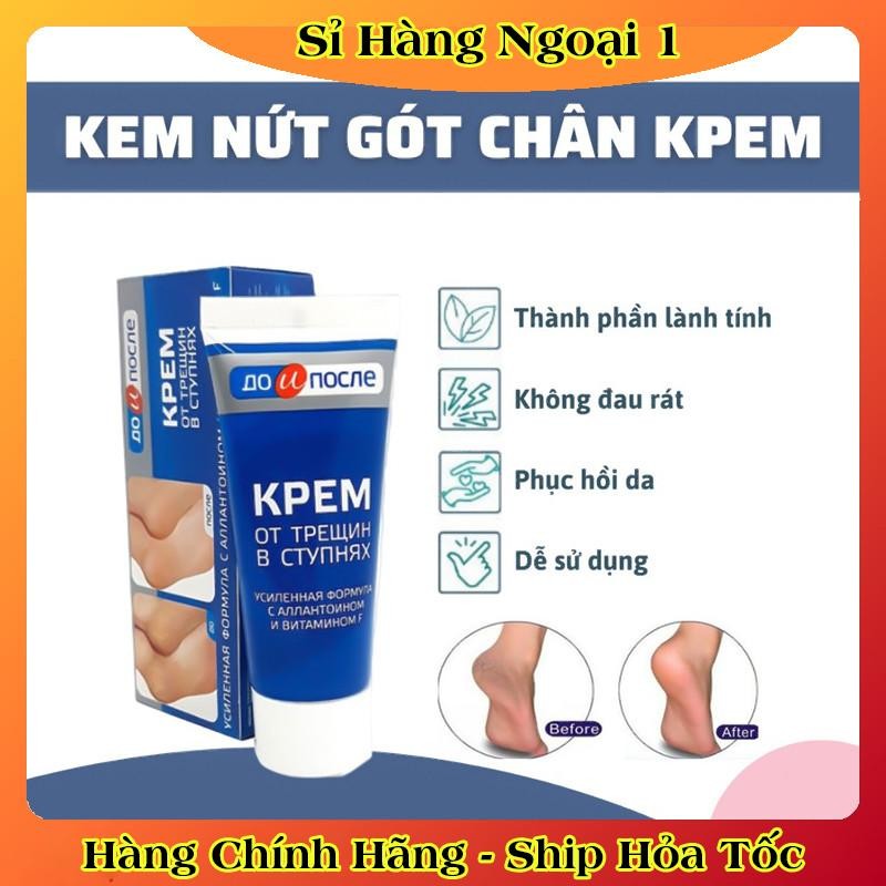 [ DATE MỚI] Kem Giảm Và Phục Hồi Nứt Nẻ Gót Chân Kpem 50ml của Nga