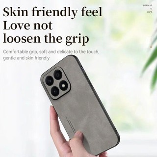 Ốp điện thoại Honor X7C Da cừu sang trọng Cảm giác da cho Huawei Honor X7C X7B X7a X9a X9b X9C 4G 5G Vỏ silicon mềm Vỏ bảo vệ Ốp điện thoại TPU chống sốc