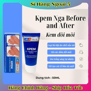 Kem đồi mồi Kpem Nga 50ml xóa mờ đồi mồi tay, tàn nhang dưỡng da tay trắng sáng mịn màng của Nga