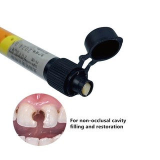 A2 Nha Khoa Nhựa Soild Ánh Sáng Chữa Ống Tiêm Chữa Đầu Giao Hàng Etch Gel Liên Kết Nha Sĩ Tiêu Thụ Phục Hồi Nha Khoa Ống Tiêm