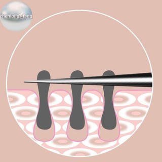 Chenlongshang 8CM Cell Pimples Blackhead Clip Nhíp Thẩm Mỹ Viện Cạo Đặc Biệt Đóng Hiện Vật Hỗ trợ giảm mụn Dụng Cụ EN