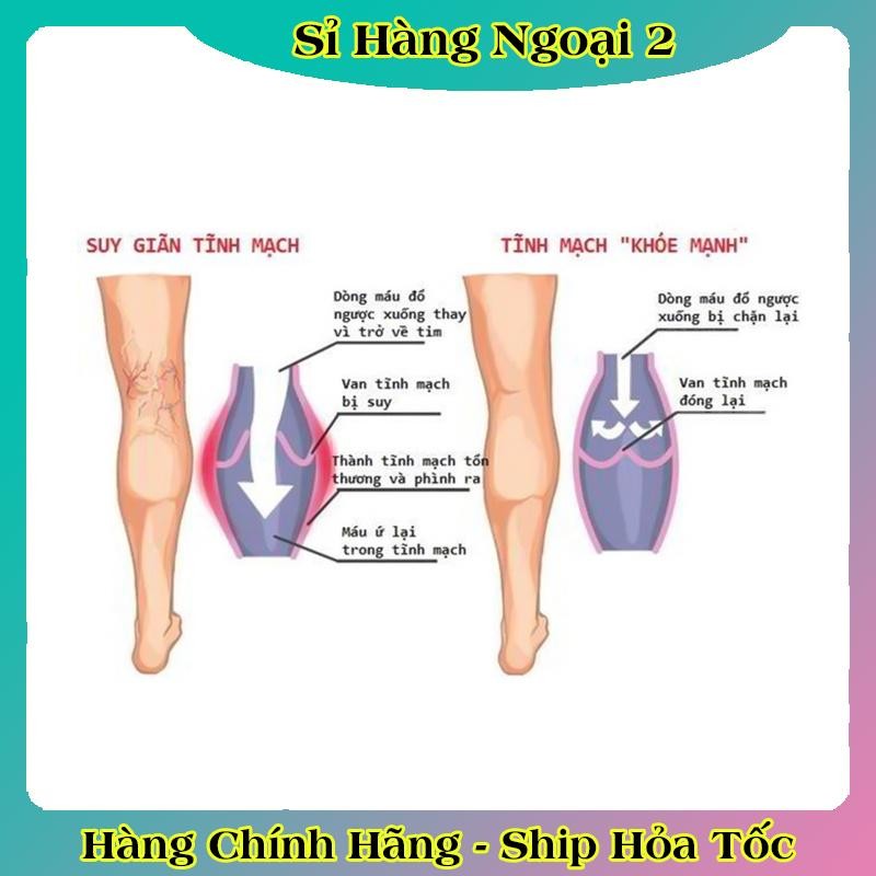 Kem Bôi giãn tĩnh mạch Abtei Venen Aktiv 125ML - Giảm suy giãn , bền vững thành mạch- Nội địa Đức date mới nhẩt