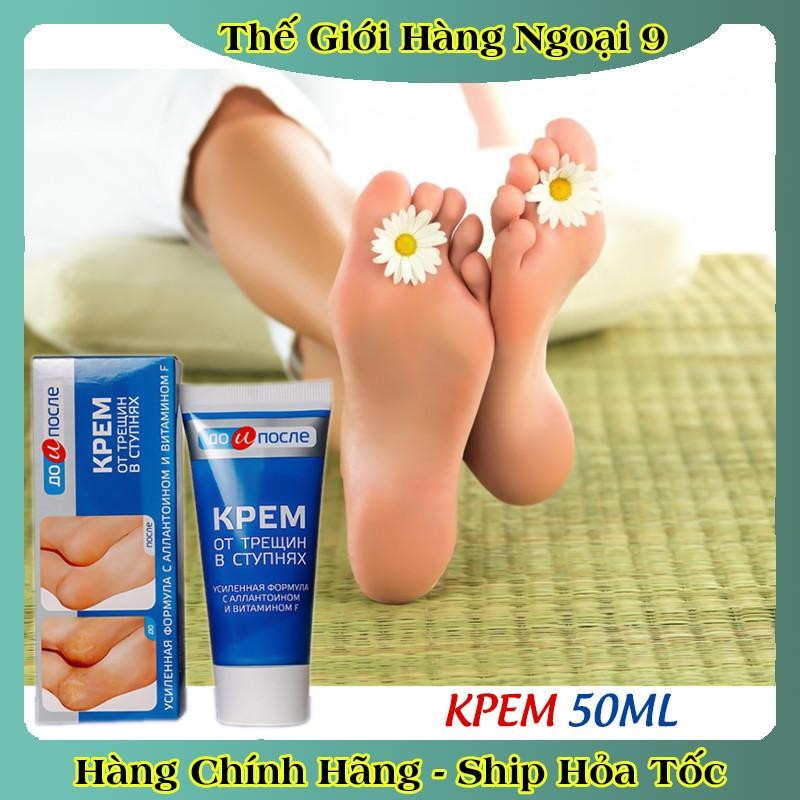 [ DATE MỚI] Kem Giảm Và Phục Hồi Nứt Nẻ Gót Chân Kpem 50ml của Nga