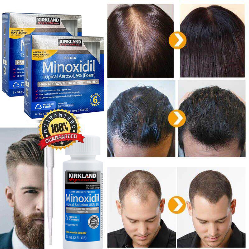 Dung dịch thoa ngoài/ Mọc tóc/mọc Râu/ Kirkland/Minoxidil 5%/Tóc ...