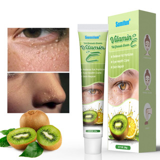 Kem Bôi Hết Sạch Mụn Thịt Quanh Mắt Và Toàn Bộ Cơ Thể  Bổ Sung Vitamin E Làm Trắng Sáng Da
