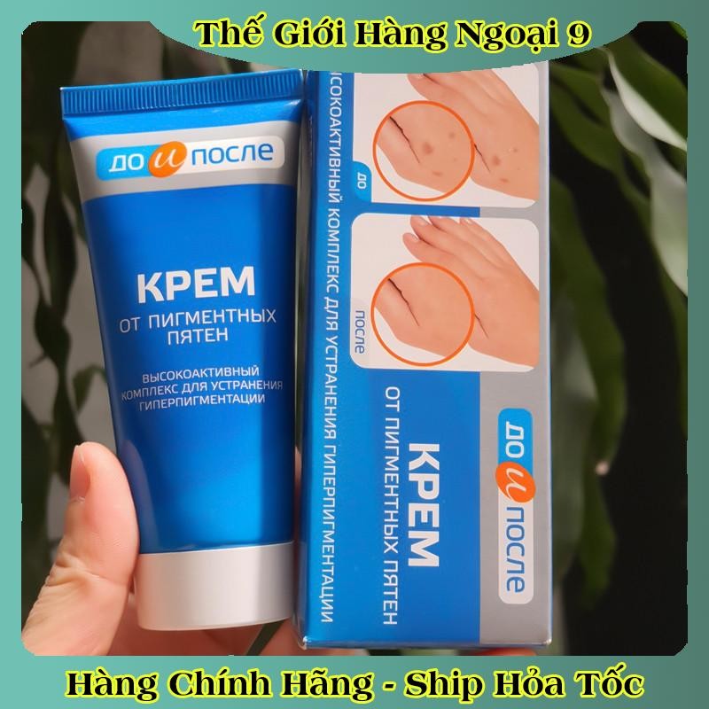 Kem đồi mồi Kpem Nga 50ml xóa mờ đồi mồi tay, tàn nhang dưỡng da tay trắng sáng mịn màng của Nga