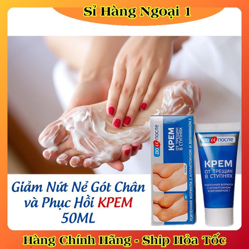 [ DATE MỚI] Kem Giảm Và Phục Hồi Nứt Nẻ Gót Chân Kpem 50ml của Nga