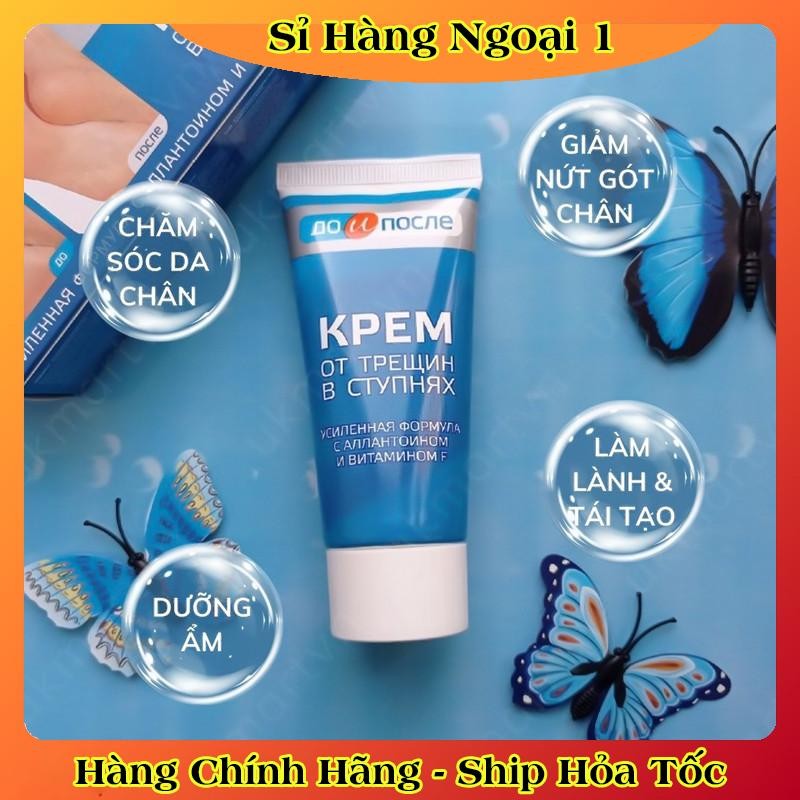 [ DATE MỚI] Kem Giảm Và Phục Hồi Nứt Nẻ Gót Chân Kpem 50ml của Nga