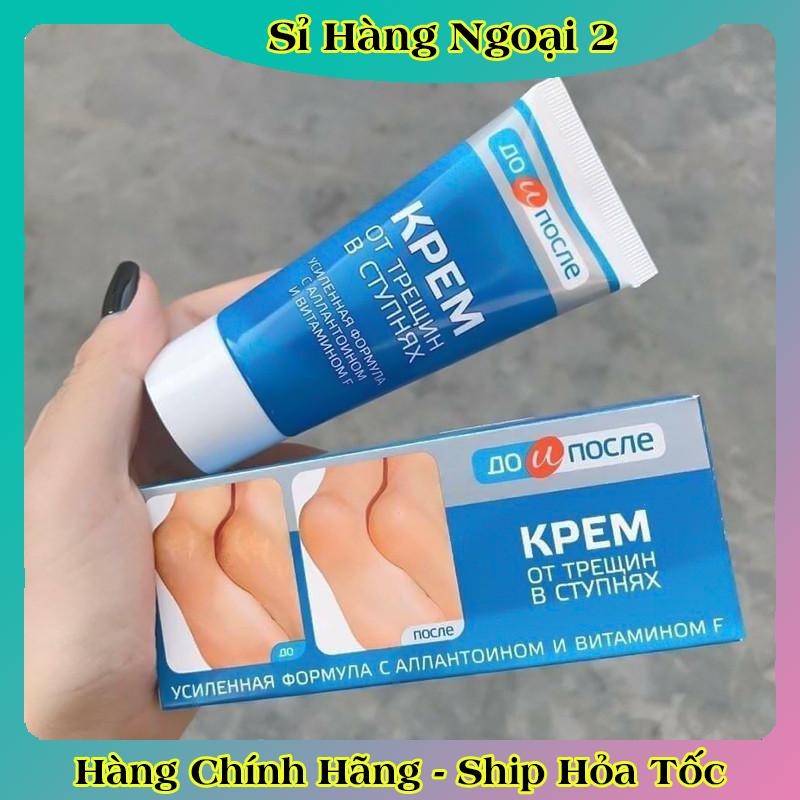 [ DATE MỚI] Kem Giảm Và Phục Hồi Nứt Nẻ Gót Chân Kpem 50ml của Nga